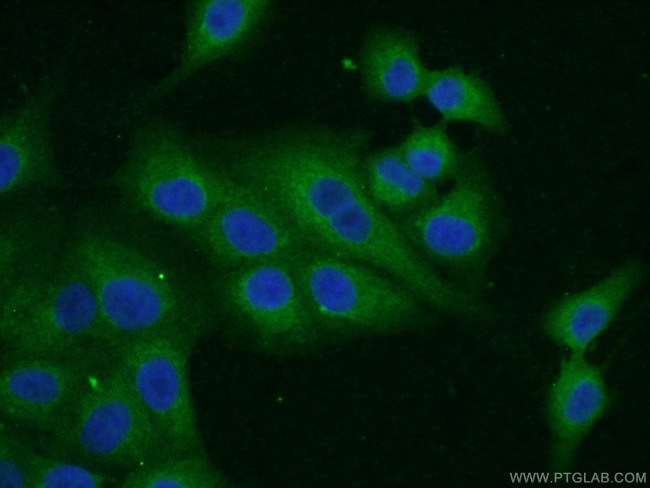 DIO1 Antibody in Immunocytochemistry (ICC/IF)