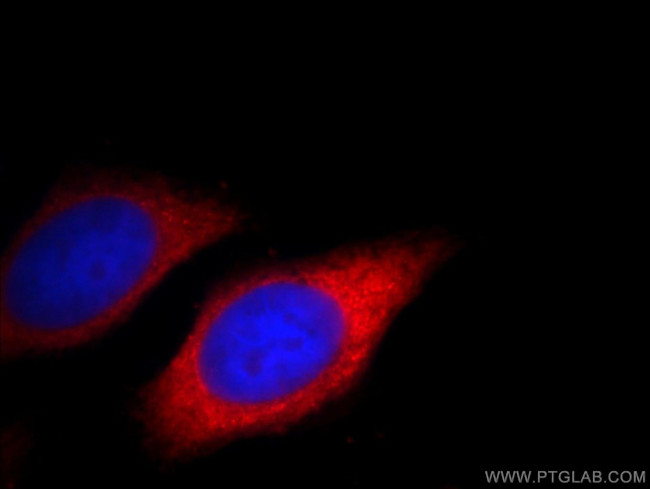 TREM1 Antibody in Immunocytochemistry (ICC/IF)