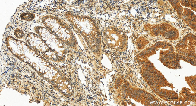 BET1 Antibody in Immunohistochemistry (Paraffin) (IHC (P))