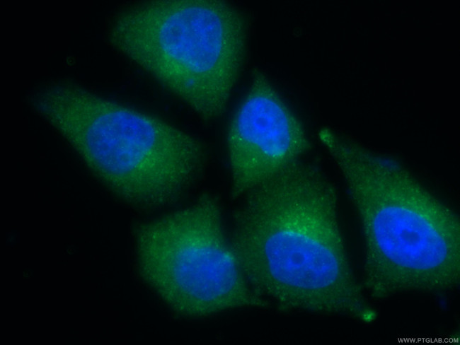 TPD52L2 Antibody in Immunocytochemistry (ICC/IF)
