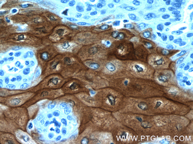 CRNN Antibody in Immunohistochemistry (Paraffin) (IHC (P))