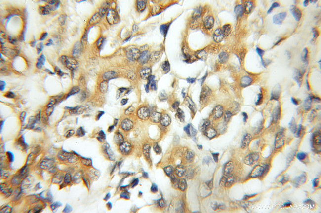 CAPZA1 Antibody in Immunohistochemistry (Paraffin) (IHC (P))