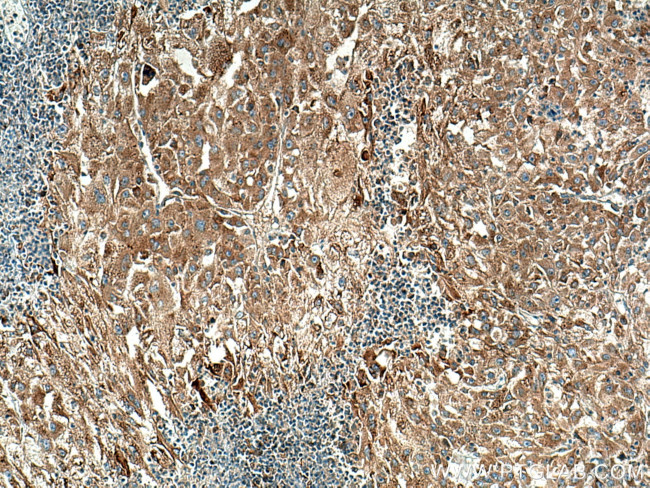 RAB10 Antibody in Immunohistochemistry (Paraffin) (IHC (P))