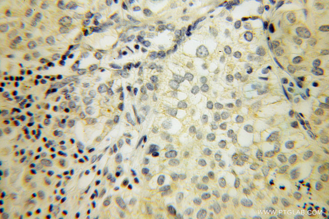 SIRP BETA 1 Antibody in Immunohistochemistry (Paraffin) (IHC (P))