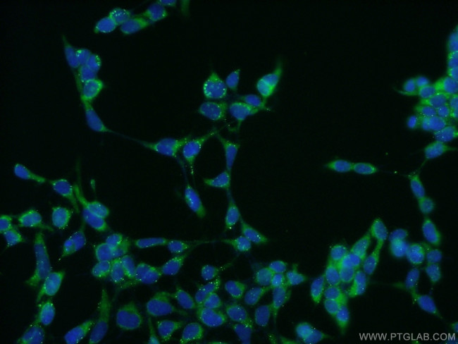 CILP2 Antibody in Immunocytochemistry (ICC/IF)