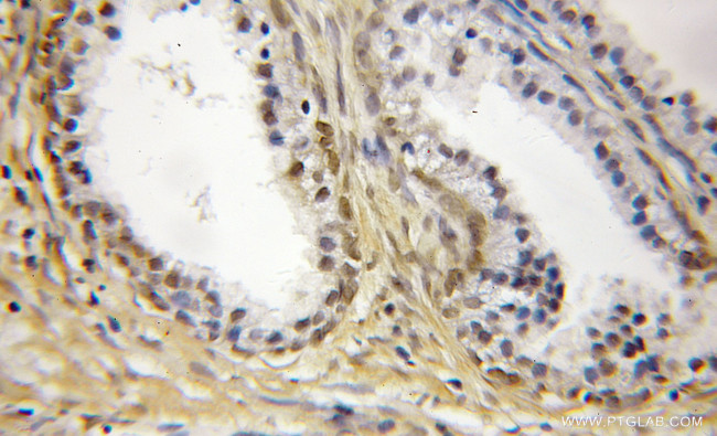 SS18L2 Antibody in Immunohistochemistry (Paraffin) (IHC (P))