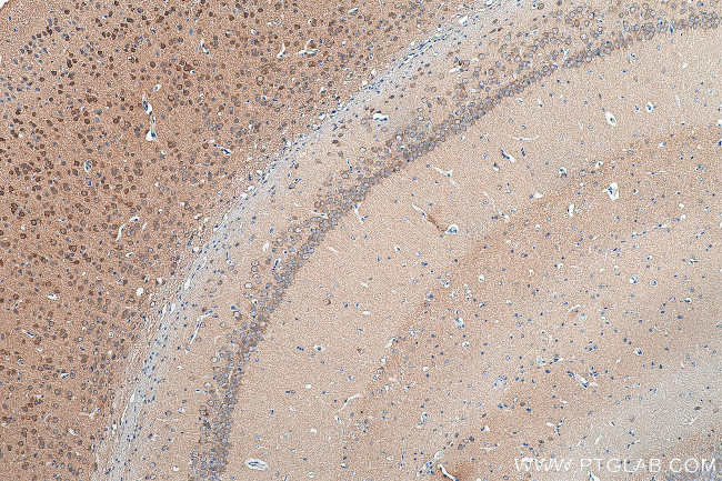 ARPP-21 Antibody in Immunohistochemistry (Paraffin) (IHC (P))