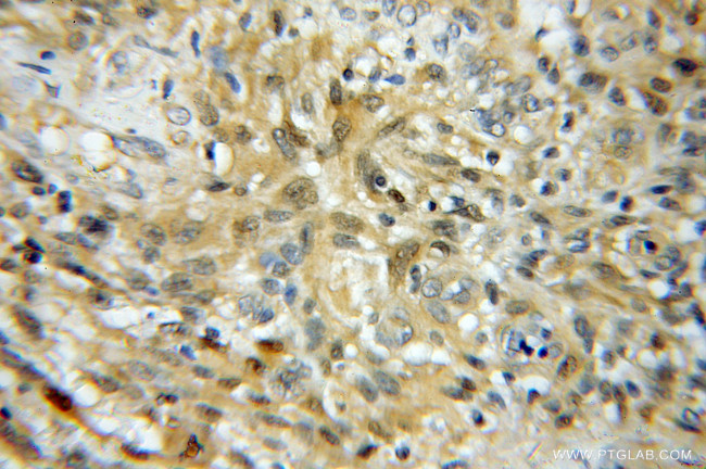 UBE2K Antibody in Immunohistochemistry (Paraffin) (IHC (P))