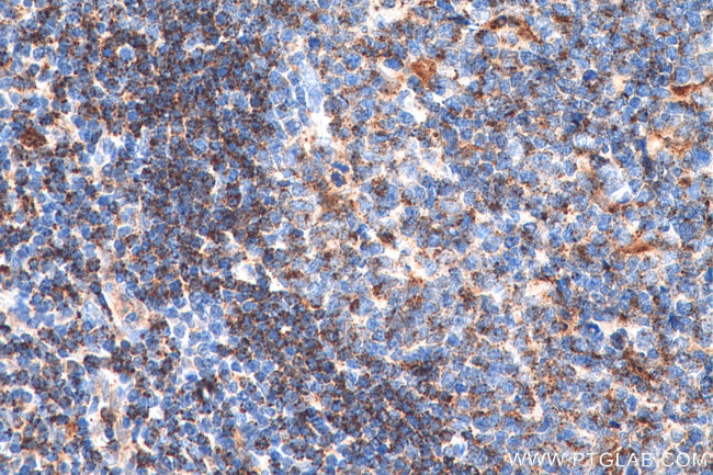 HLA-DMA Antibody in Immunohistochemistry (Paraffin) (IHC (P))