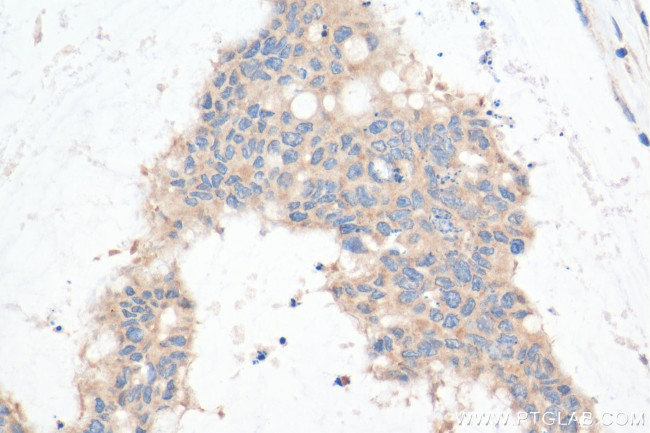 STBD1 Antibody in Immunohistochemistry (Paraffin) (IHC (P))