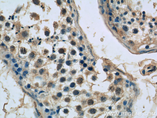 SPATA6 Antibody in Immunohistochemistry (Paraffin) (IHC (P))