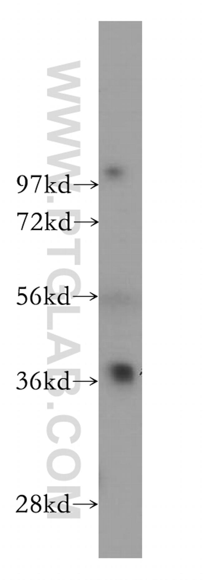 GIMAP4 Antibody in Western Blot (WB)