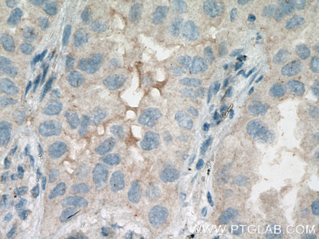 HSD17B6 Antibody in Immunohistochemistry (Paraffin) (IHC (P))