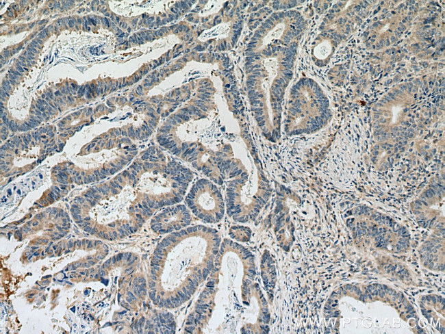 DLEU1 Antibody in Immunohistochemistry (Paraffin) (IHC (P))