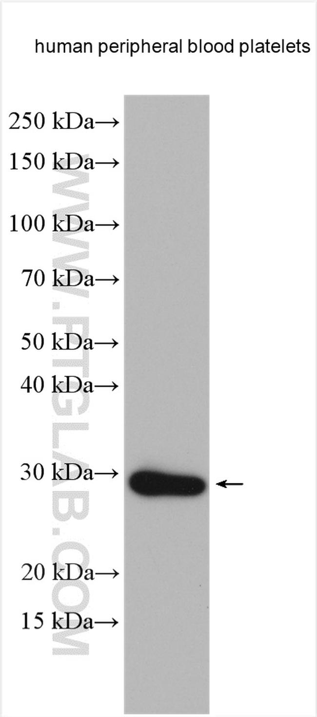 RGS18 Antibody in Western Blot (WB)