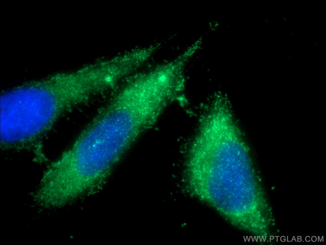 FCN3 Antibody in Immunocytochemistry (ICC/IF)