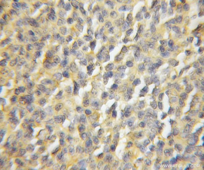 TTC4 Antibody in Immunohistochemistry (Paraffin) (IHC (P))