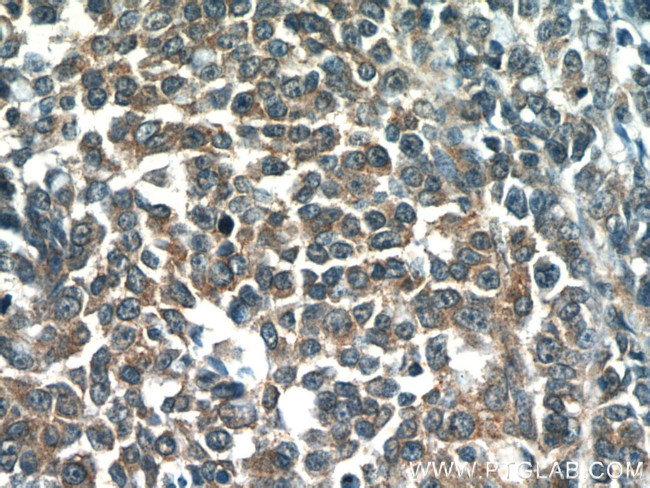 OSBPL9 Antibody in Immunohistochemistry (Paraffin) (IHC (P))