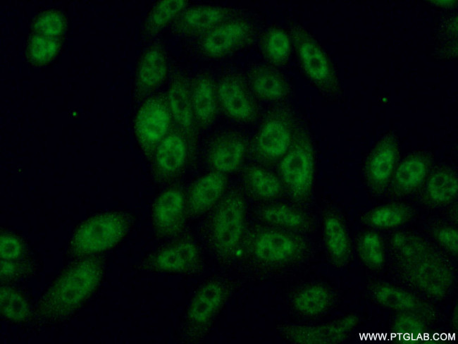 RBBP6 Antibody in Immunocytochemistry (ICC/IF)