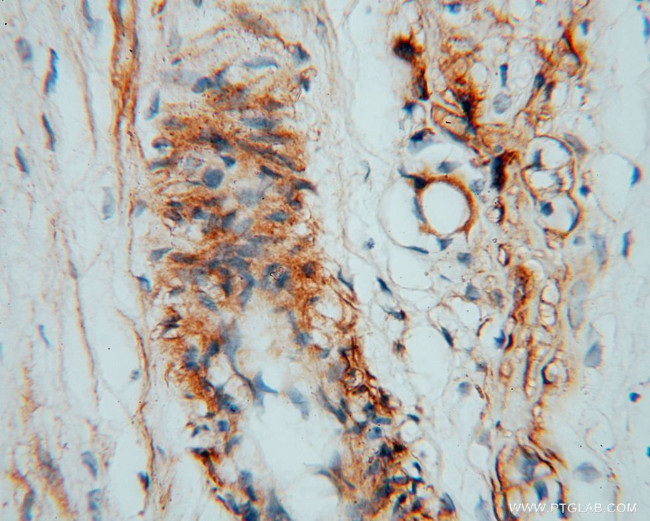 CSHL1 Antibody in Immunohistochemistry (Paraffin) (IHC (P))