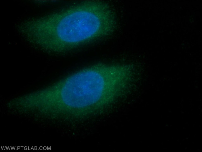 GNGT1 Antibody in Immunocytochemistry (ICC/IF)