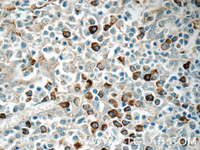 TRA Antibody in Immunohistochemistry (Paraffin) (IHC (P))
