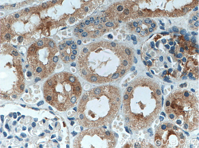 MIB1 Antibody in Immunohistochemistry (Paraffin) (IHC (P))