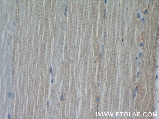 XIRP2 Antibody in Immunohistochemistry (Paraffin) (IHC (P))