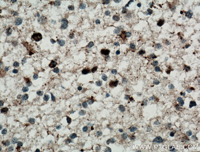 TERF1 Antibody in Immunohistochemistry (Paraffin) (IHC (P))