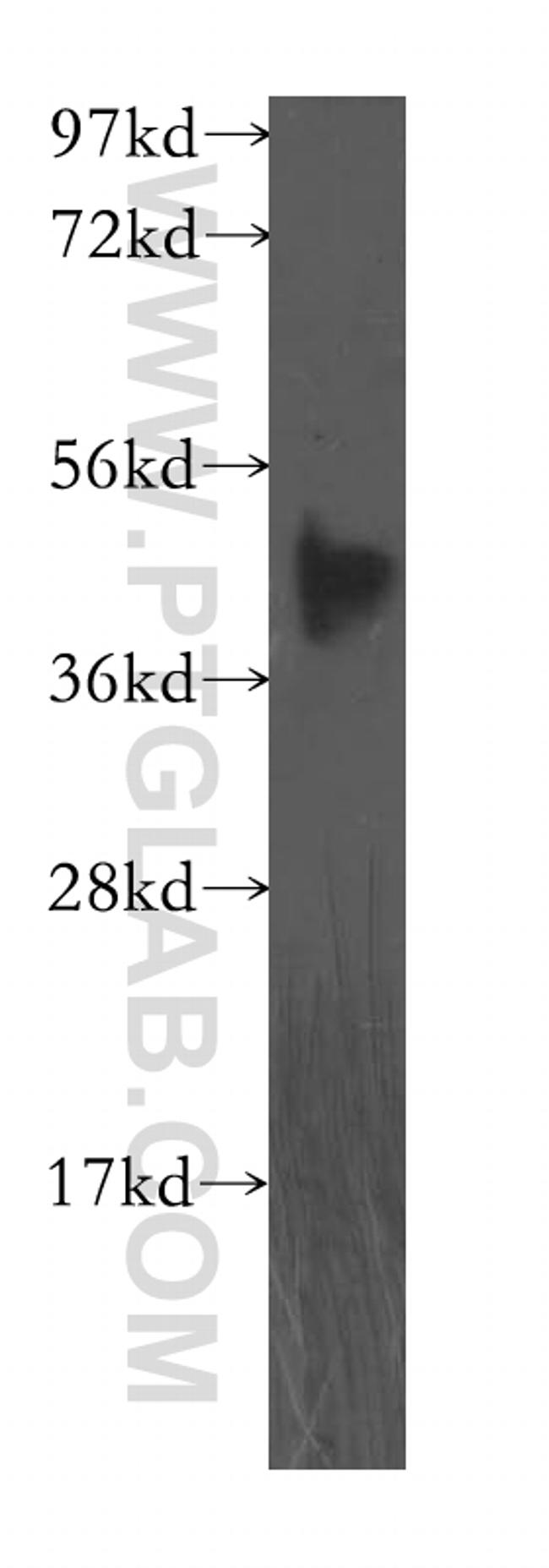FBXO8 Antibody in Western Blot (WB)