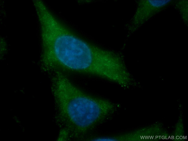 SCEL Antibody in Immunocytochemistry (ICC/IF)