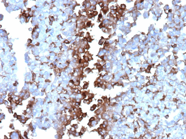 Clusterin/Apolipoprotein J (APO-J) Antibody in Immunohistochemistry (Paraffin) (IHC (P))