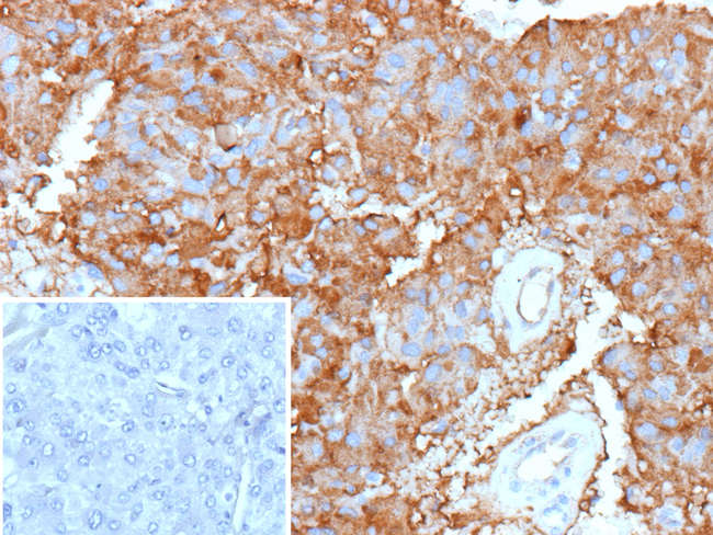 Clusterin/Apolipoprotein J (APO-J) (Marker of Anaplastic Large Cell Lymphoma) Antibody in Immunohistochemistry (Paraffin) (IHC (P))