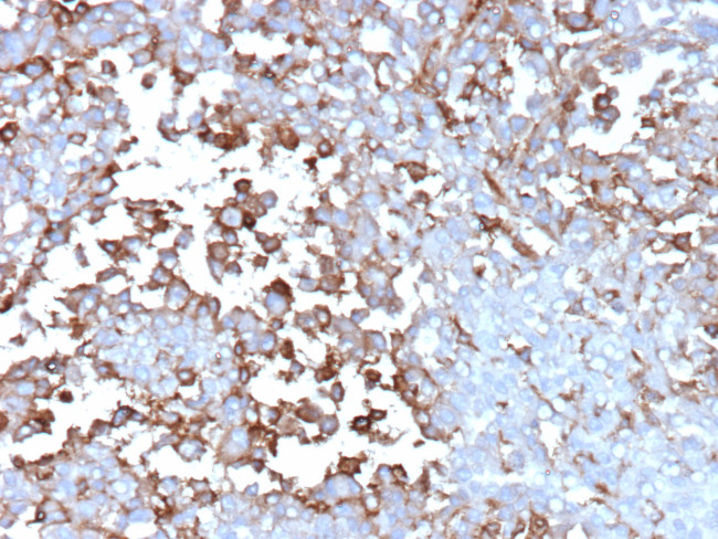 Clusterin/Apolipoprotein J (APO-J) Antibody in Immunohistochemistry (Paraffin) (IHC (P))