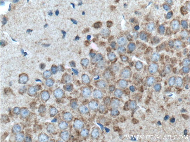 GPR125 Antibody in Immunohistochemistry (Paraffin) (IHC (P))