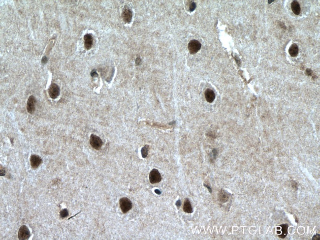 PLRG1 Antibody in Immunohistochemistry (Paraffin) (IHC (P))