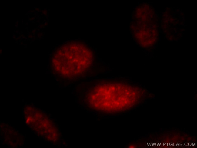 AGFG2 Antibody in Immunocytochemistry (ICC/IF)