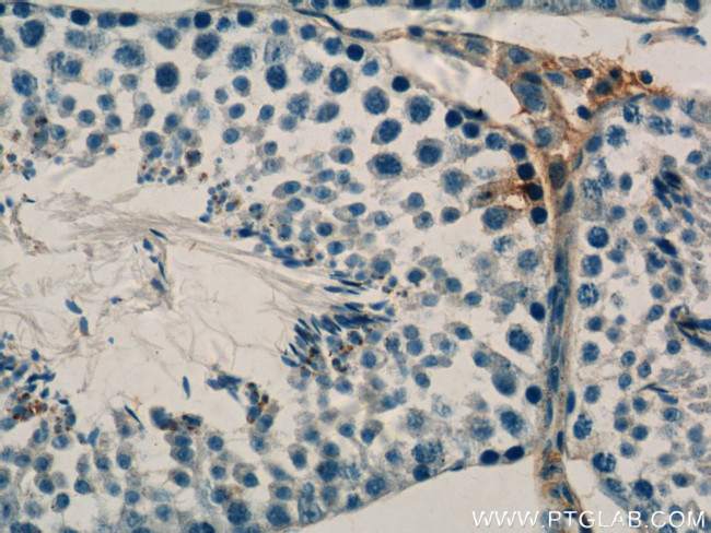LYZL6 Antibody in Immunohistochemistry (Paraffin) (IHC (P))