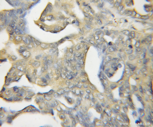 Calcyphosine 2 Antibody in Immunohistochemistry (Paraffin) (IHC (P))