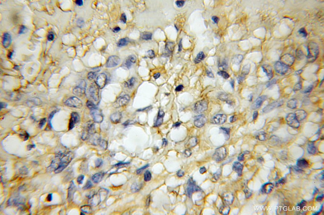 GPR137 Antibody in Immunohistochemistry (Paraffin) (IHC (P))