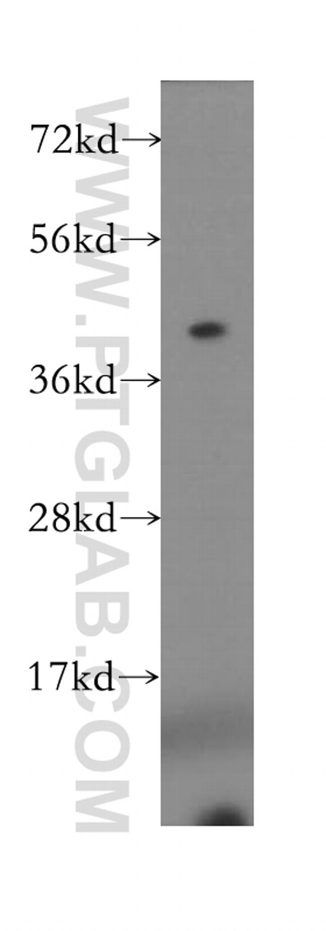 MS4A6A Antibody in Western Blot (WB)