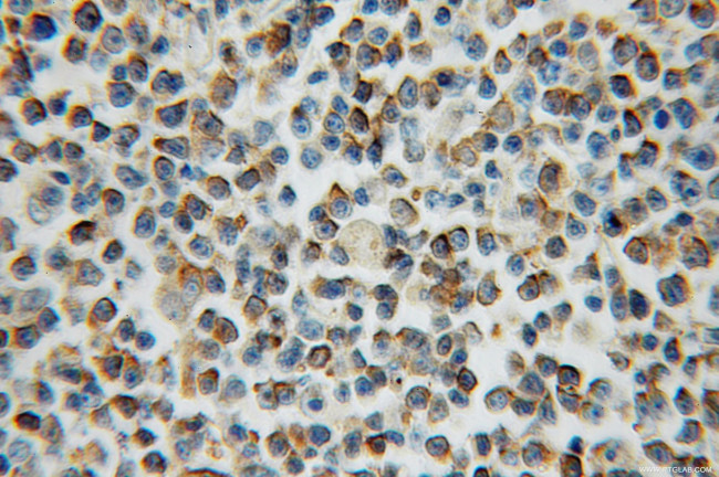 ARL15 Antibody in Immunohistochemistry (Paraffin) (IHC (P))