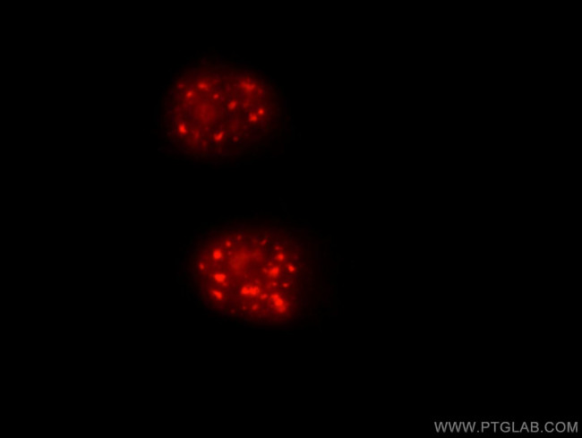 Cyclin E2 Antibody in Immunocytochemistry (ICC/IF)
