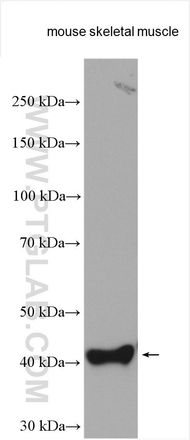 Beta sarcoglycan Antibody in Western Blot (WB)