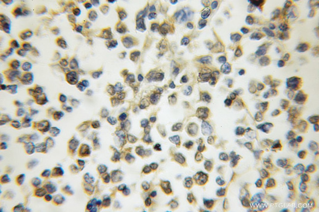 ARHGAP15 Antibody in Immunohistochemistry (Paraffin) (IHC (P))