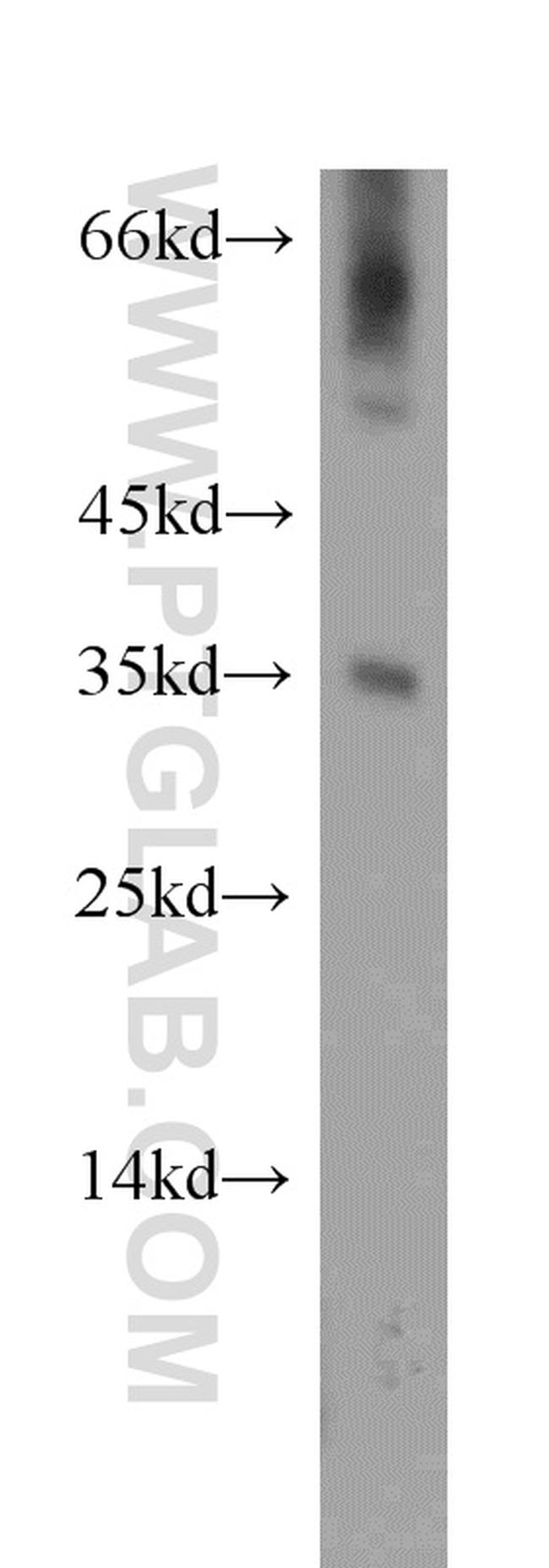 DOK5 Antibody in Western Blot (WB)