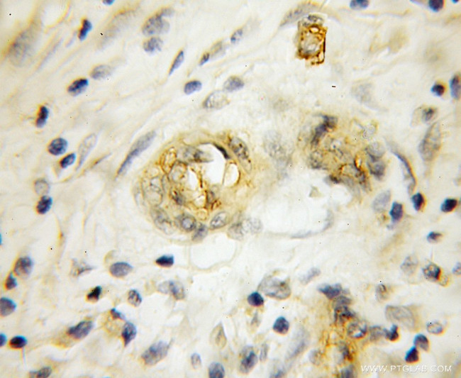 RHCG Antibody in Immunohistochemistry (Paraffin) (IHC (P))