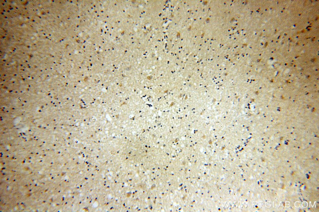 PSTPIP1 Antibody in Immunohistochemistry (Paraffin) (IHC (P))