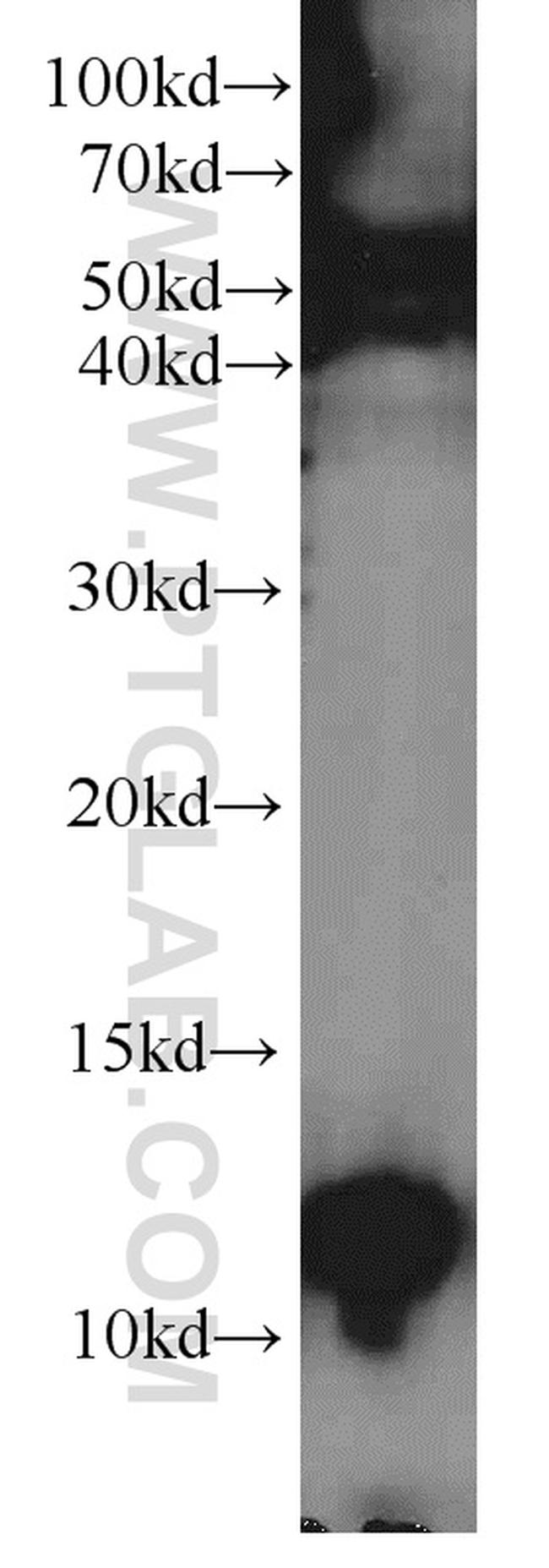 PCBD2 Antibody in Western Blot (WB)