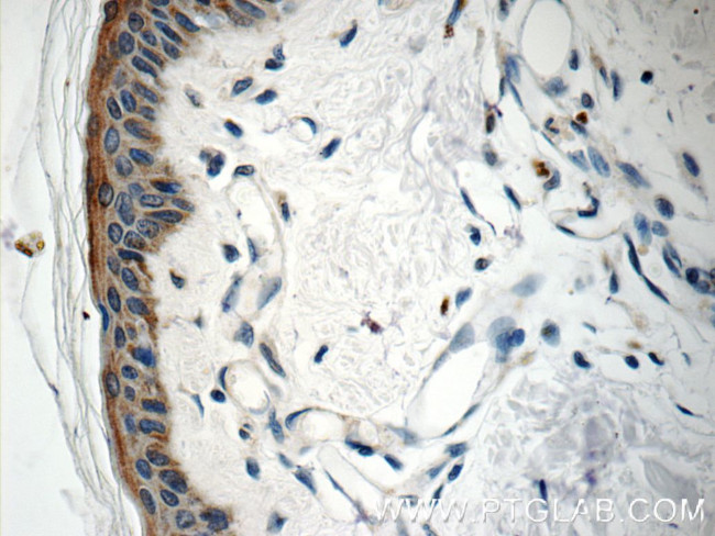 SPRR1B Antibody in Immunohistochemistry (Paraffin) (IHC (P))